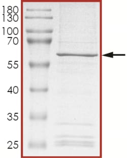 Sino Biological&nbsp;Recombinant Mouse CCRK Protein (Full Length, GST Tag)